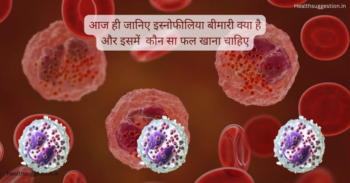 इस्नोफीलिया में कौन सा फल खाना चाहिए -Eosinophilia in Hindi