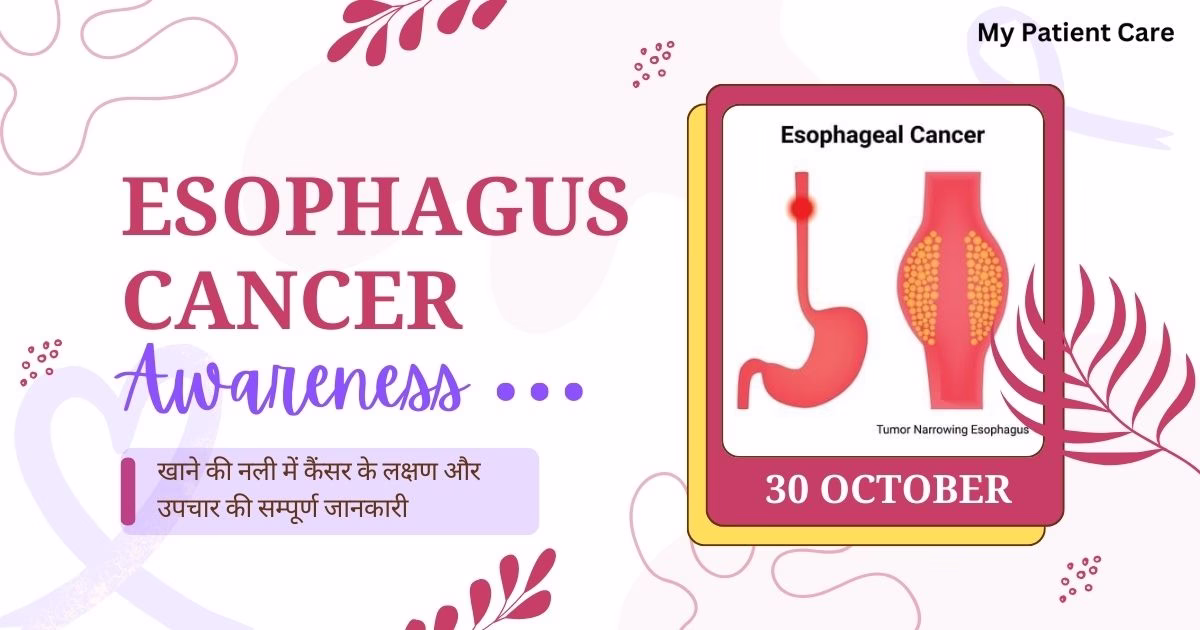 khane ki nali me cancer ke lakshan